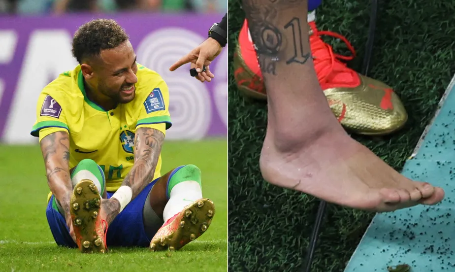Lesão de Neymar ‘cede’ e dá esperança de volta contra Camarões; veja