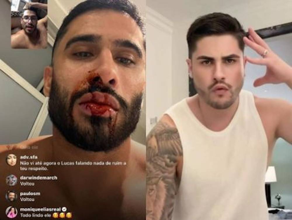 Ex-namorado mostra rosto sangrando acusa Lucas Souza e ameaça expor vídeo íntimo: ‘Vou soltar tudo’